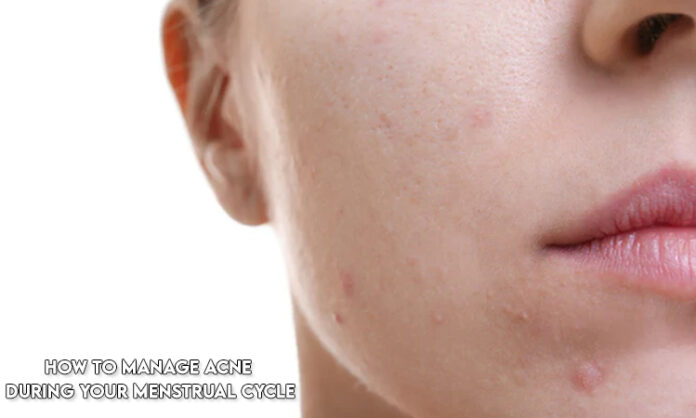 How to Manage Acne During Your Menstrual Cycle