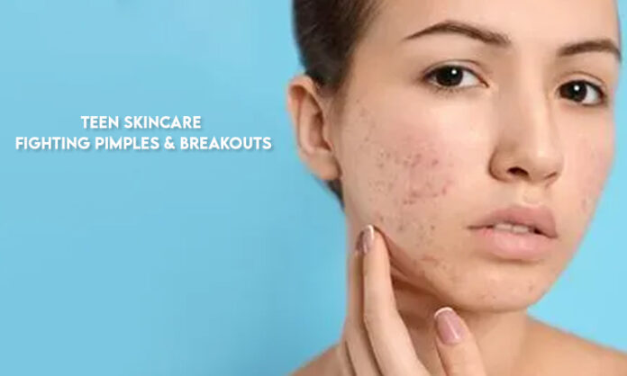 Teen Skincare: Fighting Pimples & Breakouts